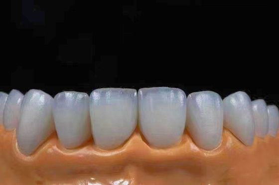 acheter Des couronnes en zirconium esthétique très translucides, parfaitement adaptées à l'aspect naturel. fabrication en ligne