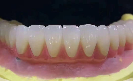 acheter Dentistique sur mesure couronne dentaire en zirconium résistant aux taches avec une haute précision fabrication en ligne
