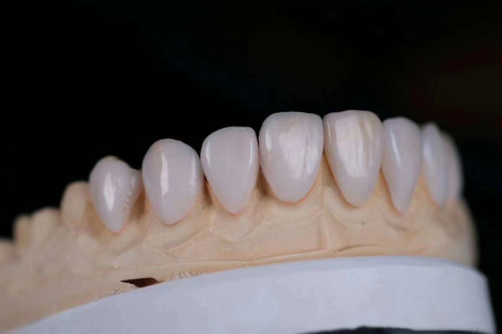 acheter Couronne en céramique de zirconium multicouches de longue durée réglable avec certification FDA fabrication en ligne