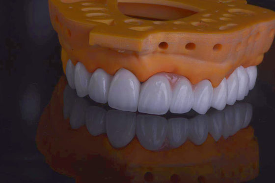 acheter Des couronnes dentaires naturelles de haute résistance pour la restauration des dents fabrication en ligne