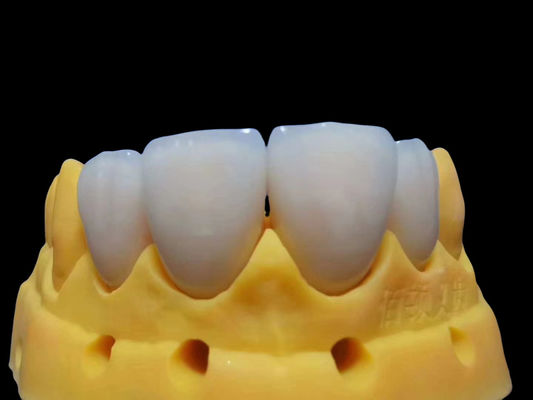 acheter Résistant aux déchirures, adapté à la couronne en zirconium, personnalisable, sans danger d'utilisation fabrication en ligne