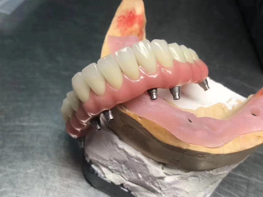 acheter Implant solide à haute translucide à couronne supportée personnalisable pour la restauration dentaire fabrication en ligne