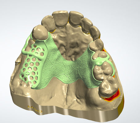 acheter Cadre métallique numérique CAD CAM Conception dentaire Matériau Cocr avec impression 3D fabrication en ligne