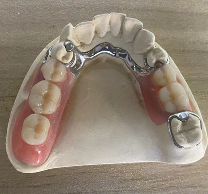 acheter Résistance à la corrosion des prothèses dentaires de cadre métallique d'argent fiable avec conception personnalisable fabrication en ligne