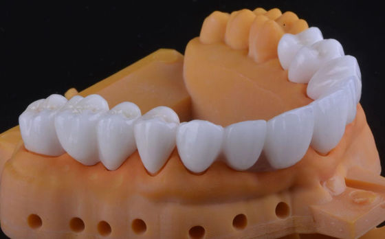 Couronne dentaire en zirconium de haute résistance ultra-translucide avec stabilité à long terme
