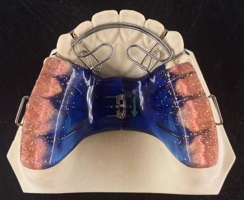 Appareil d'orthodontie amovible de haute précision