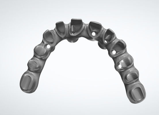 Systèmes CAD CAM personnalisables pour la restauration des dents