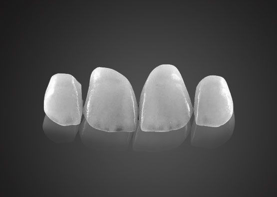 IPS 0.2 mm Veneers Emax ultra minces résistant aux taches avec une grande résistance