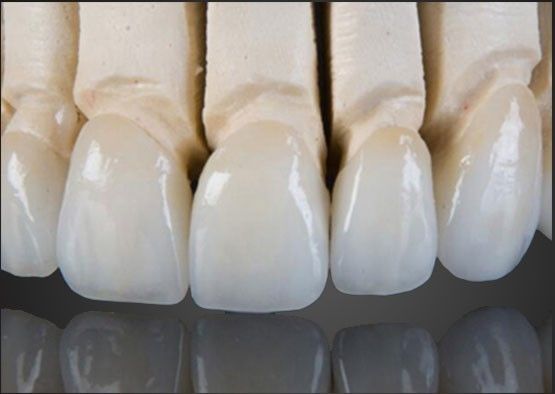Wieland Zirconia Toutes les couronnes en céramique Peinture intérieure personnalisée avec conception CAO