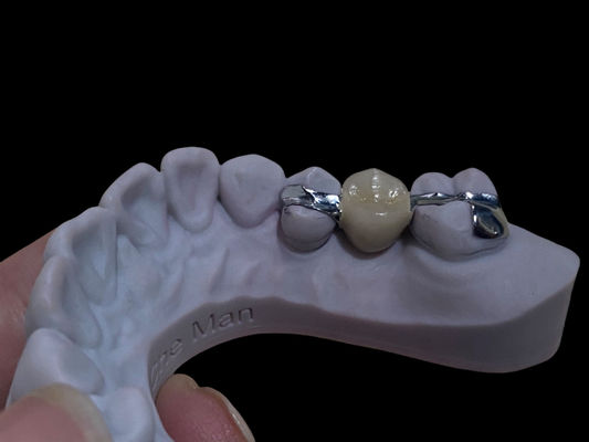 Dentiste de pont de Maryland, de longue durée et de couleur blanche.
