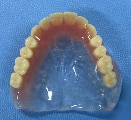 Résistance aux taches Prothèse acrylique complète Haute stabilité avec forme en arc complet
