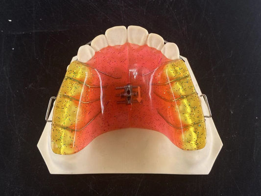 Appareil orthodontique personnalisé à 2 voies