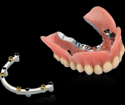 Screw à barres en titane fraisée pour implant dentaire avec une surface lisse et polie