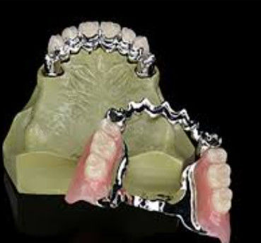 Utilisation à long terme Dentistique personnalisée avec clé et porte-clés à haute résistance