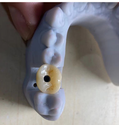 Nom